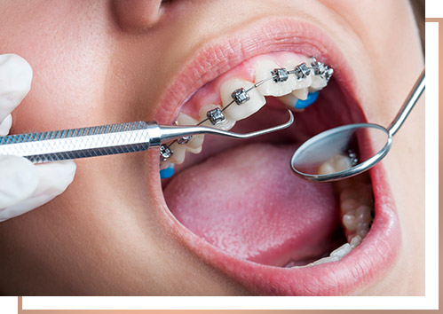 ortodoncja-medico