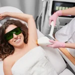 epilacja laserowa co to